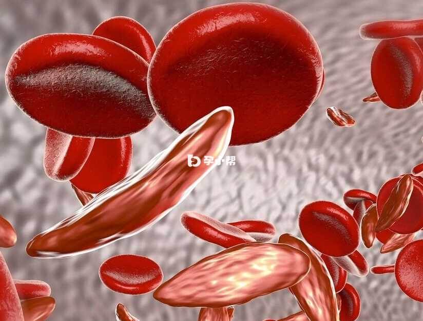 叶酸缺乏导致的巨幼红细胞性贫血