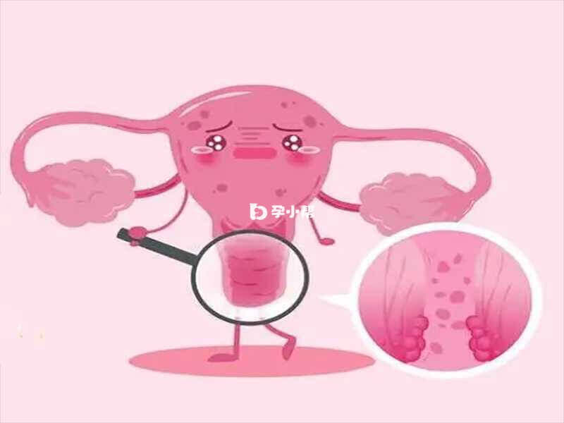 卵巢早衰是女性常见的疾病