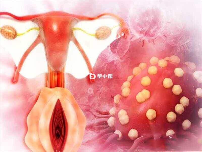 身体达到移植要求后便可进行胚胎移植