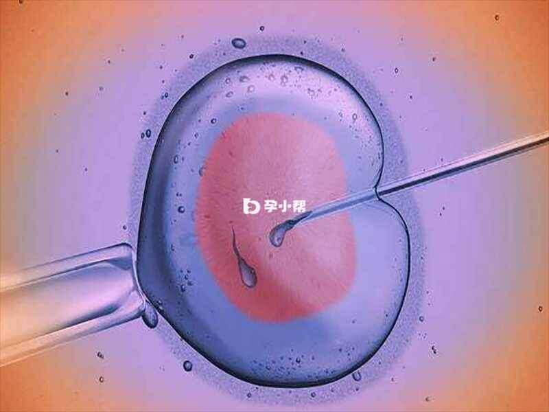 微刺能帮助卵巢储备低的女性获取更多卵子