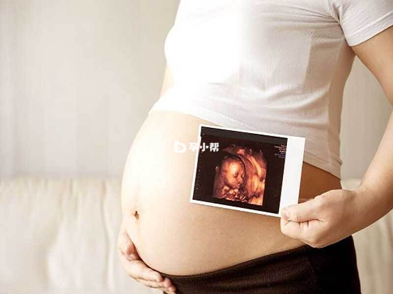 孕妇做四维彩超检查部分胎儿疾病