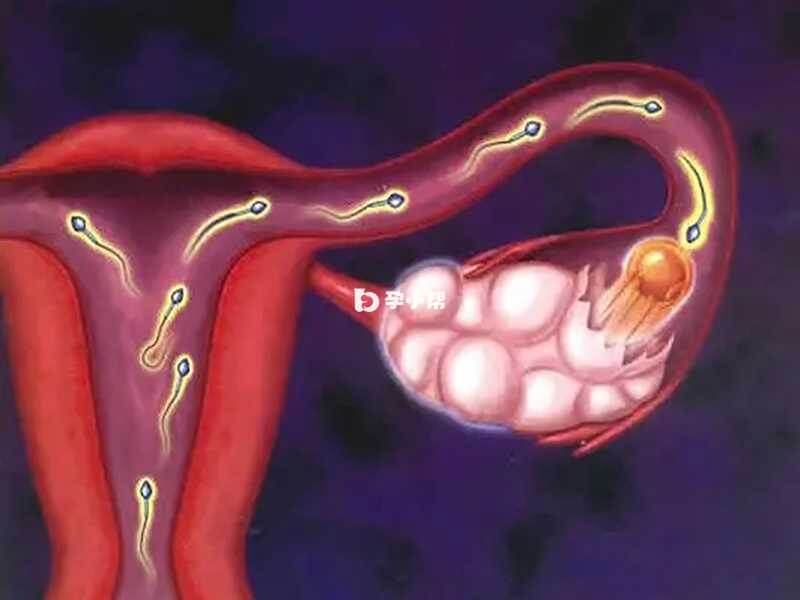 先天性卵巢发育不全