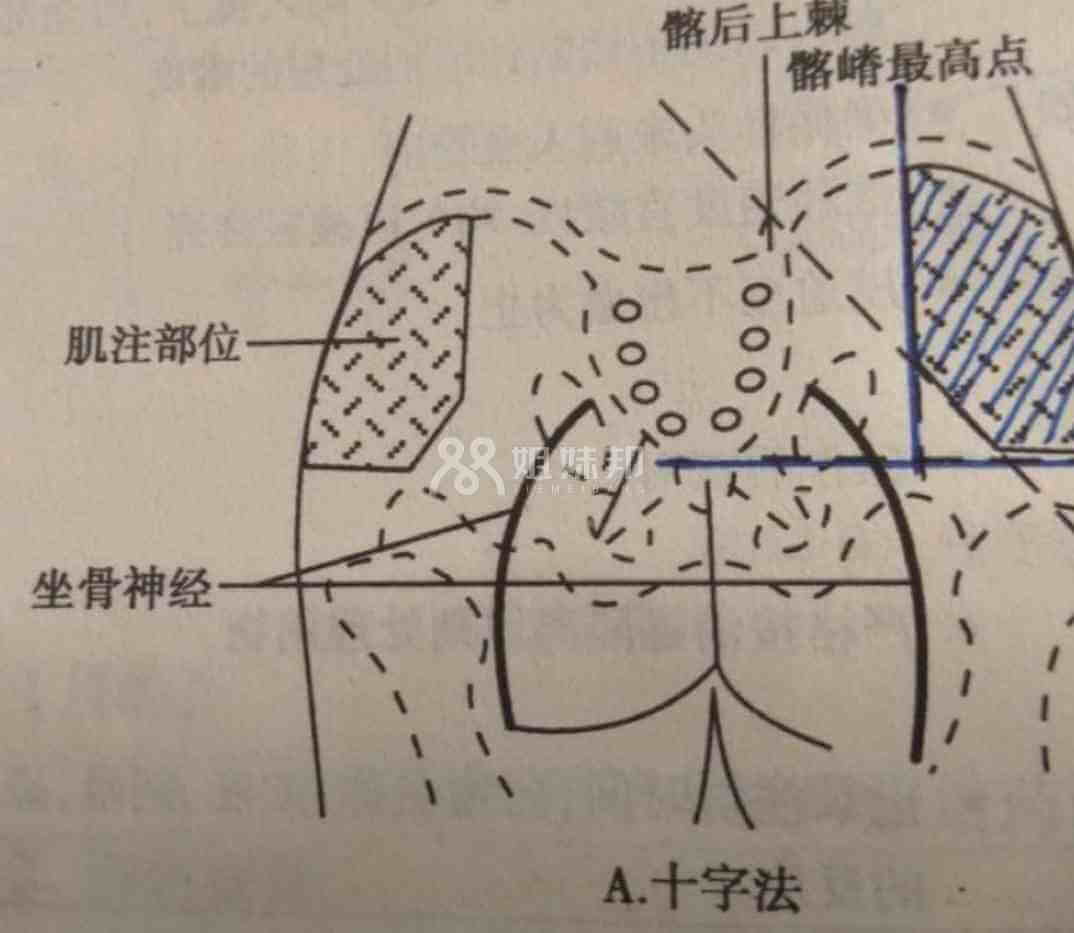 注射位置