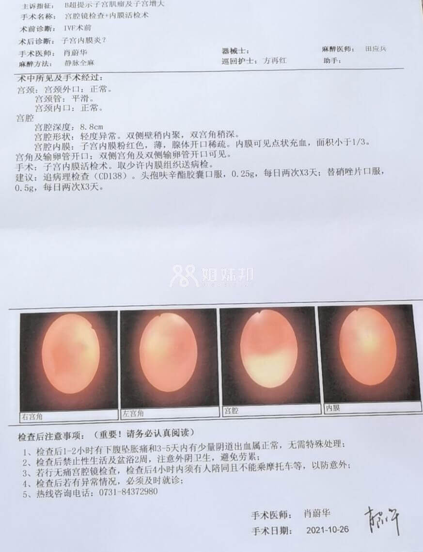 宫腔镜检查报告