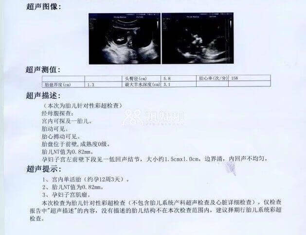 B超检查结果