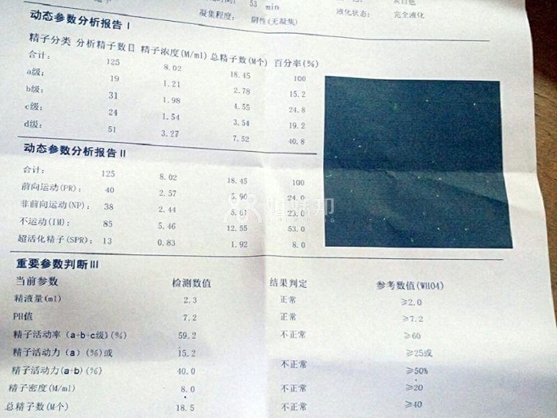 精子检查报告