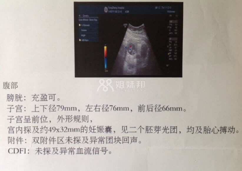 超声报告