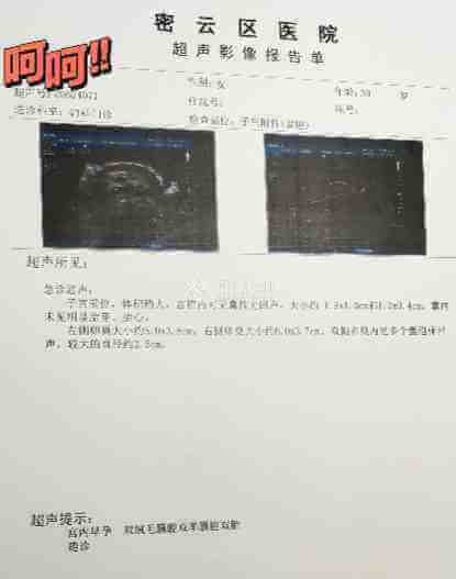 B超显示孕5周+4