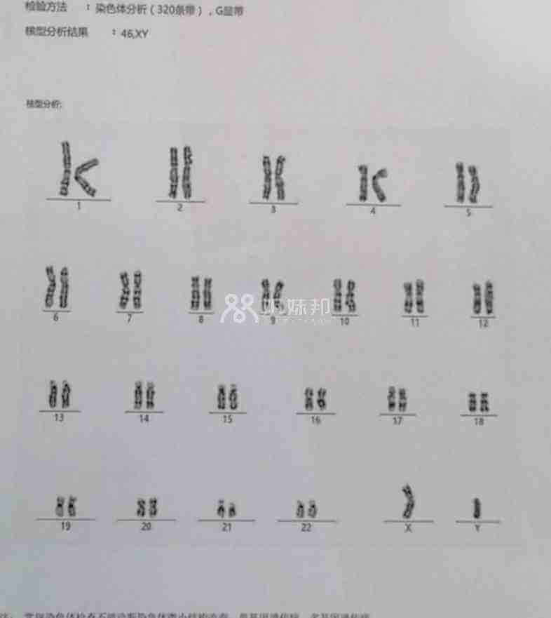 染色体报告
