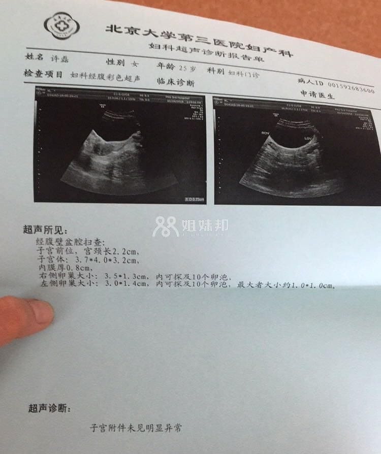 检查报告