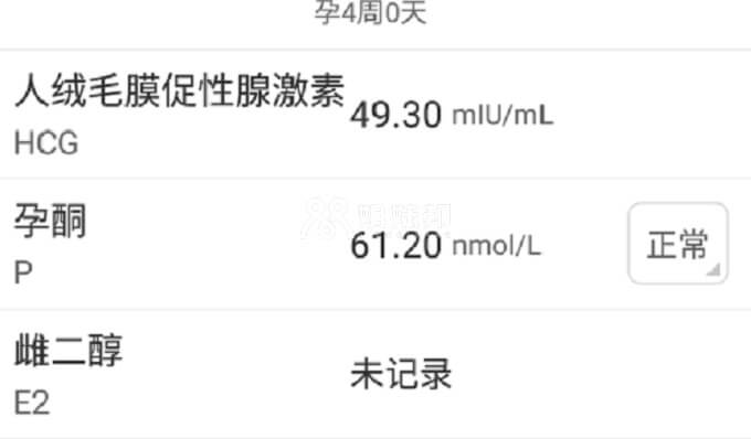 孕4周检查报告单