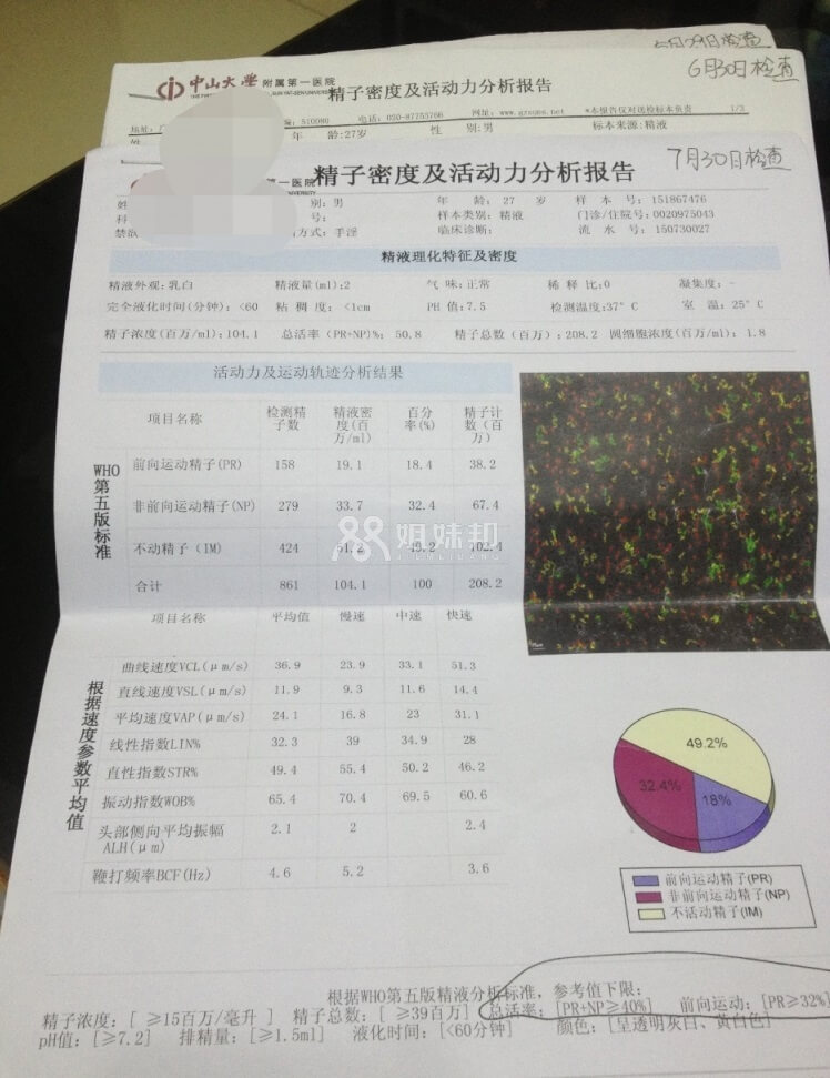 老公的精子活力检查单