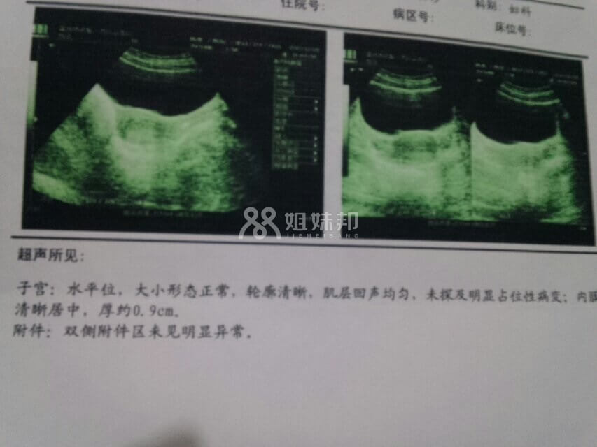 b超检查单五