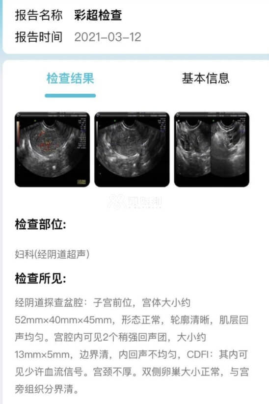 阴超检查报告