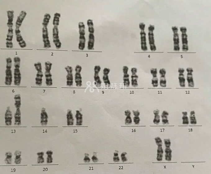 关于染色体的一些形态变化