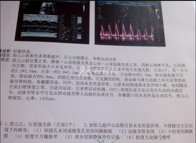 心脏彩超结论