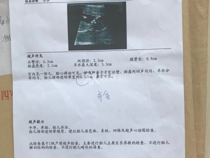 建议做羊穿的报告单