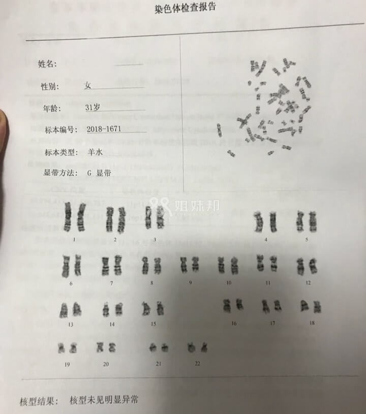  羊水穿刺检查报告单