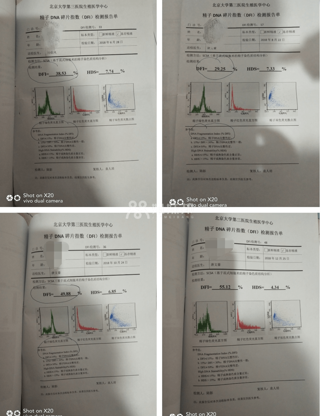 精子DNA碎片指数