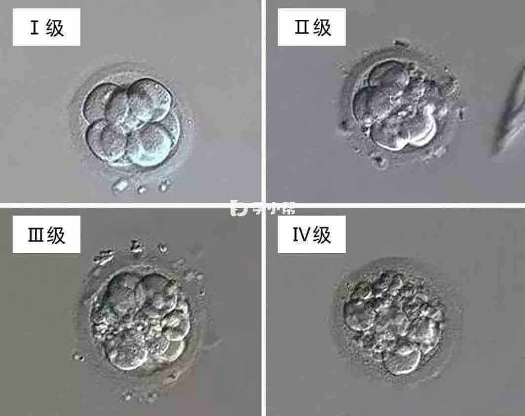 胚胎质量划分为四个等级