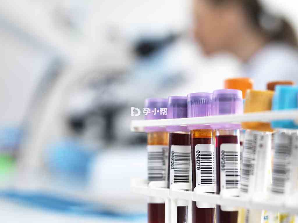抽血检测HCG可确认是否怀孕