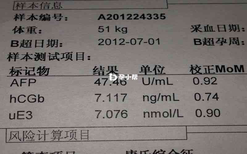 唐氏筛查检查报告单