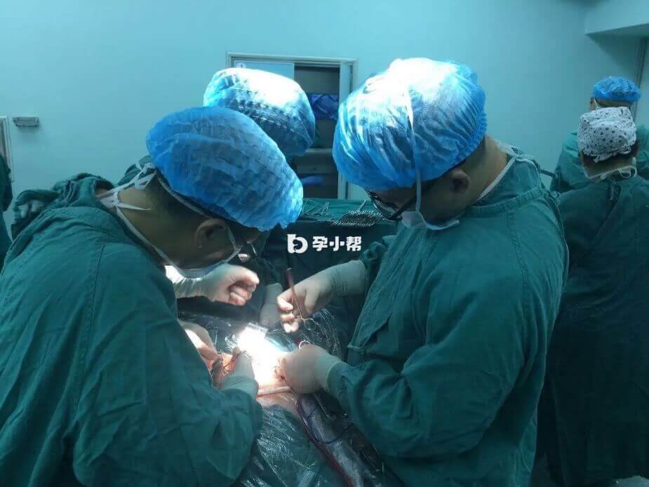 宫腔分离术