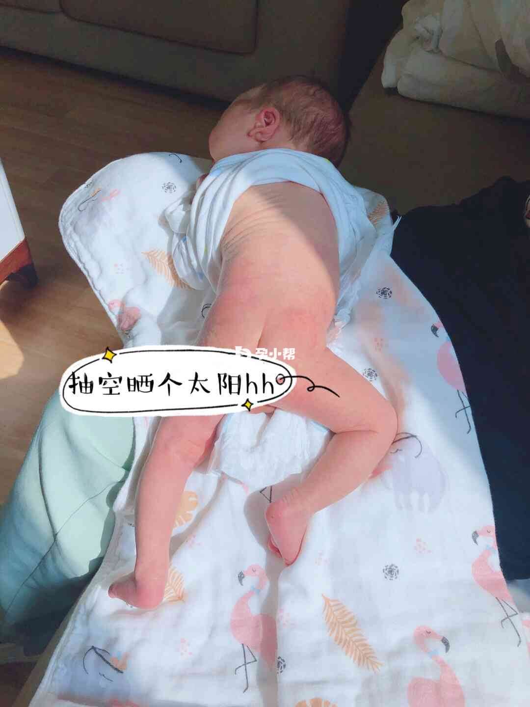 可以用光照疗法