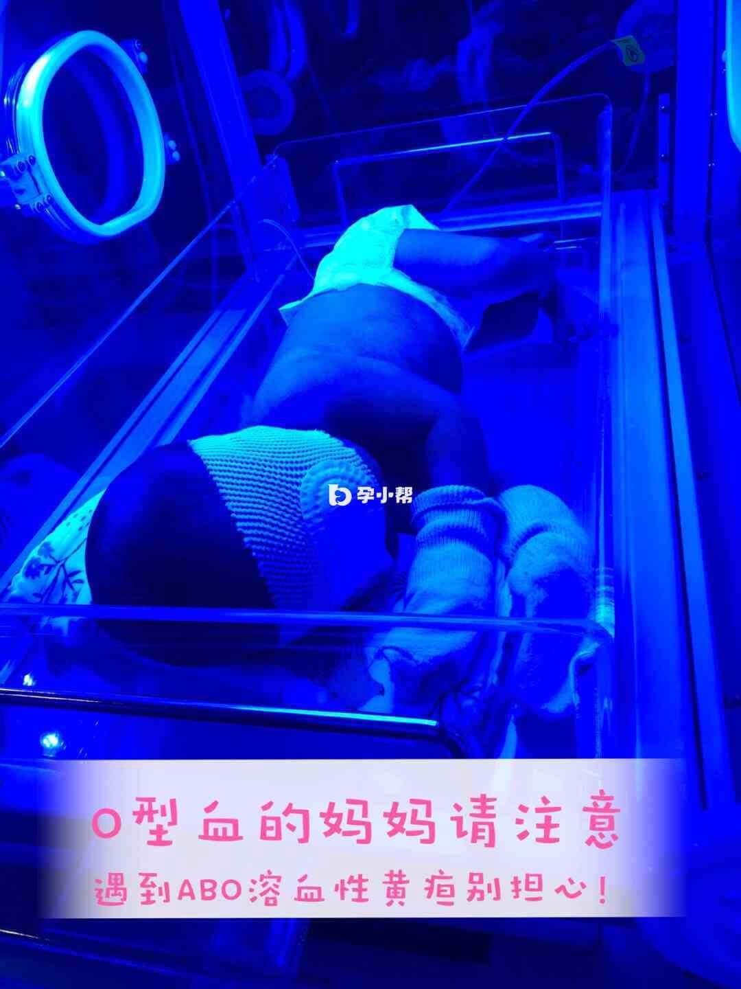 ABO溶血的情况