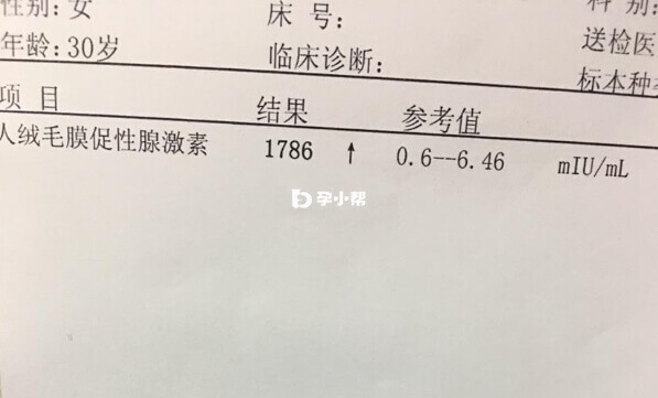 人绒毛膜促性腺激素