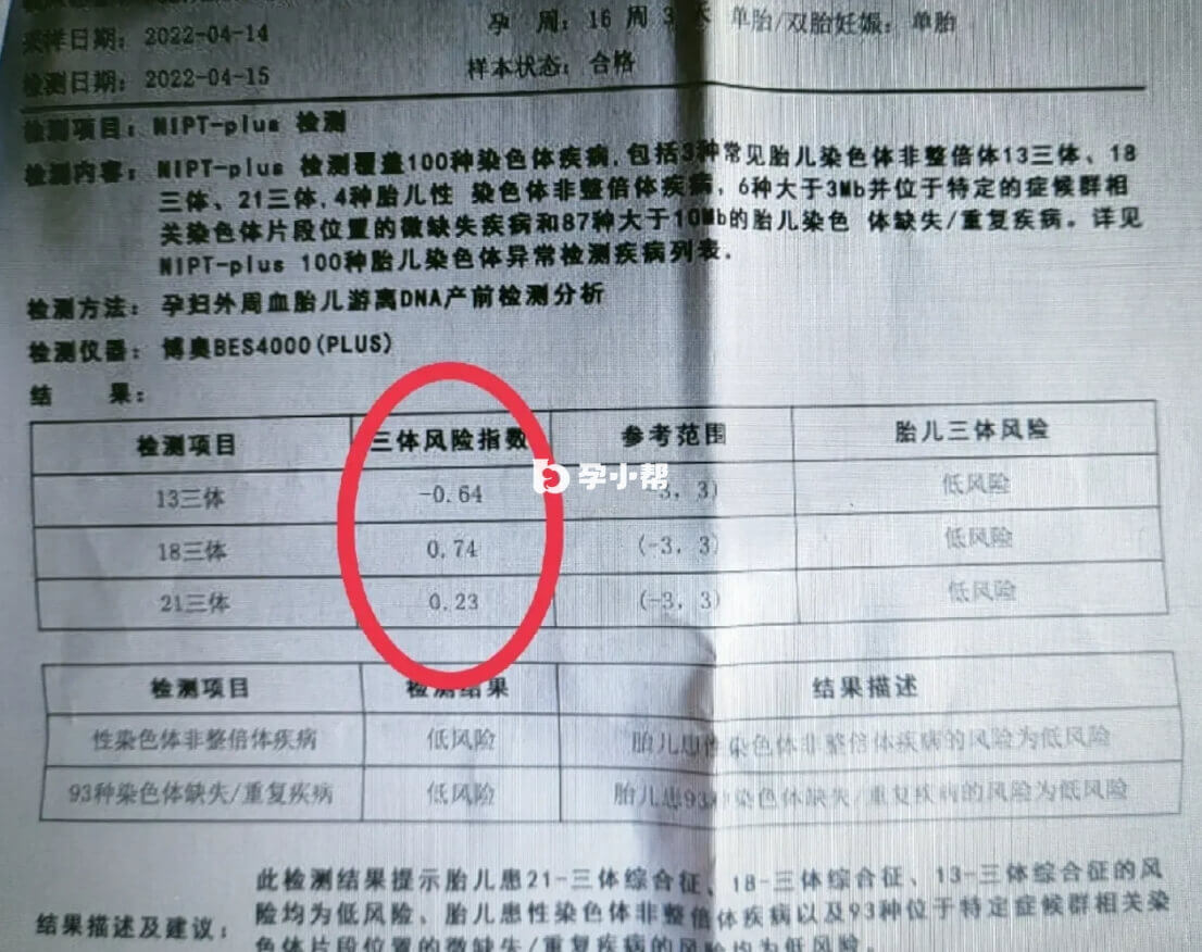 无创报告单