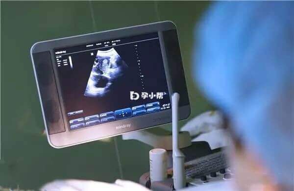 查看胚胎植入情况