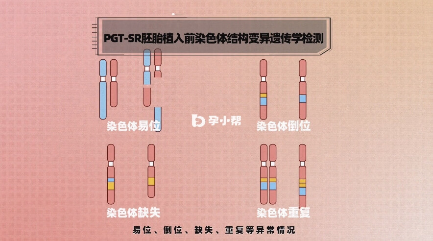 染色体平衡易位携带