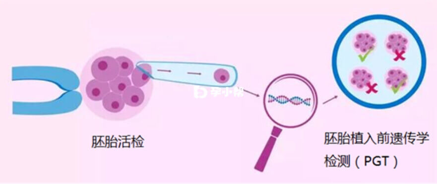 柳州三代试管