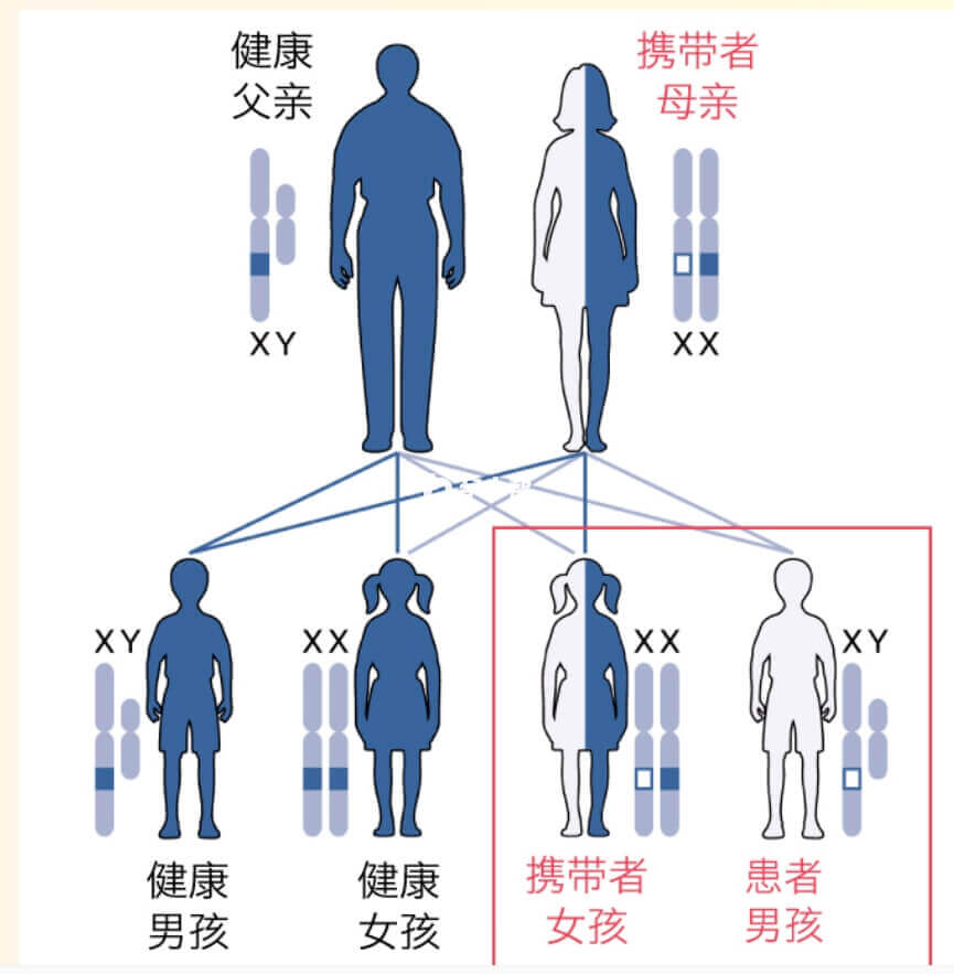 脆性X综合征