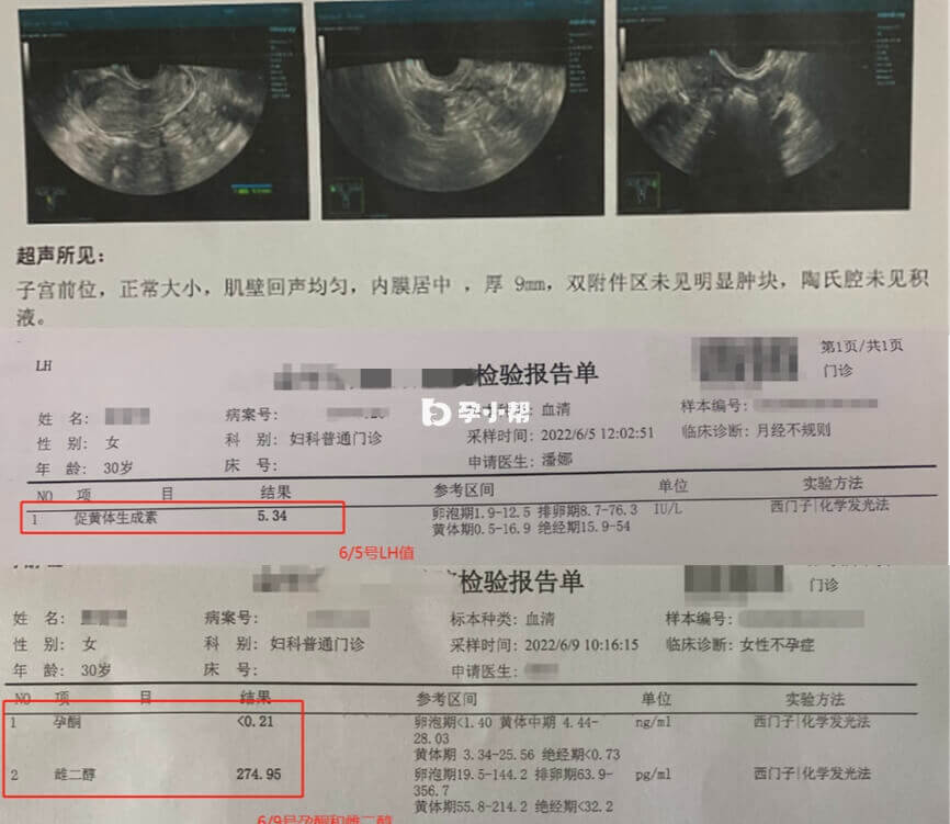 移植前各种检查单