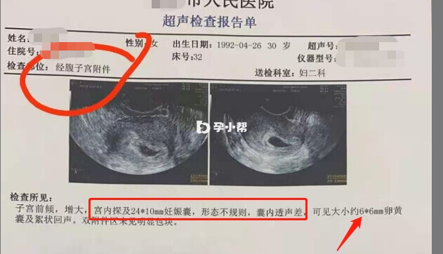 超声报告单