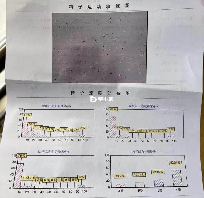 老公患有无精症