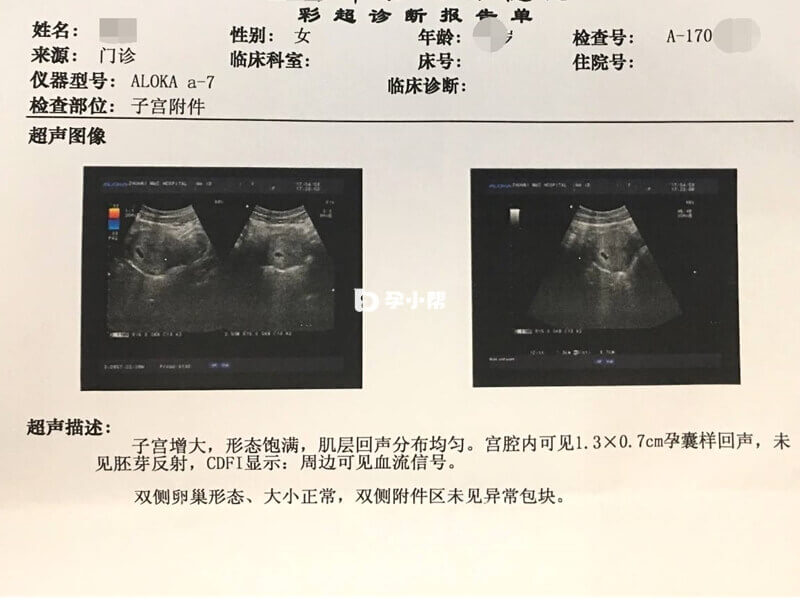 孕九周感到腹部疼痛的检查