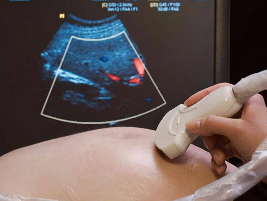 孕妇要定期检查是否患有脐带绕颈