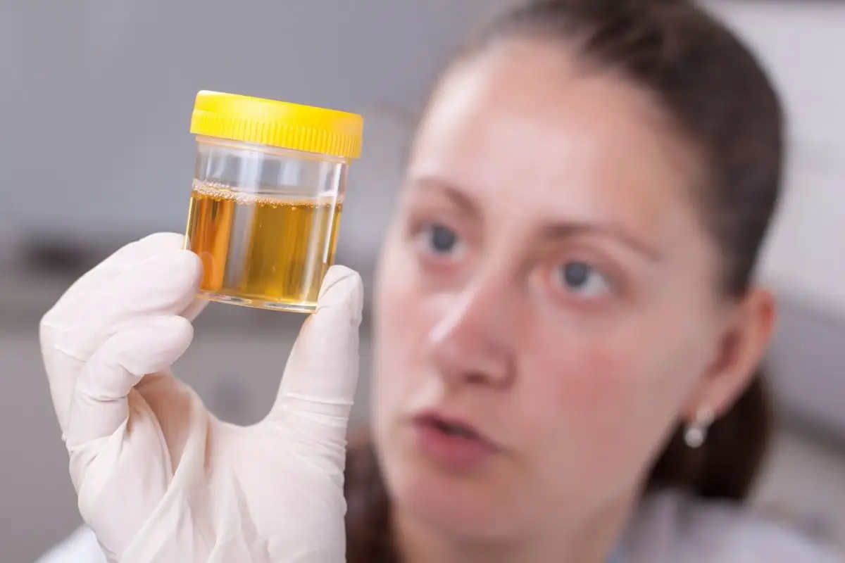 注意用一个干净透明的杯子收集尿液