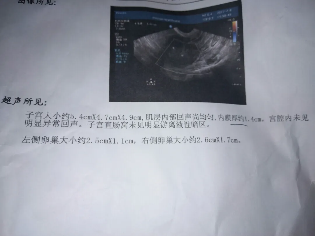 子宫内膜厚影像学检查结果