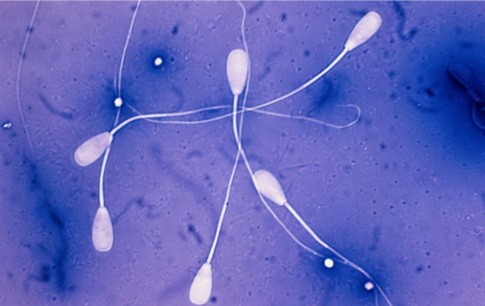 精子按照活力率分为四种类型
