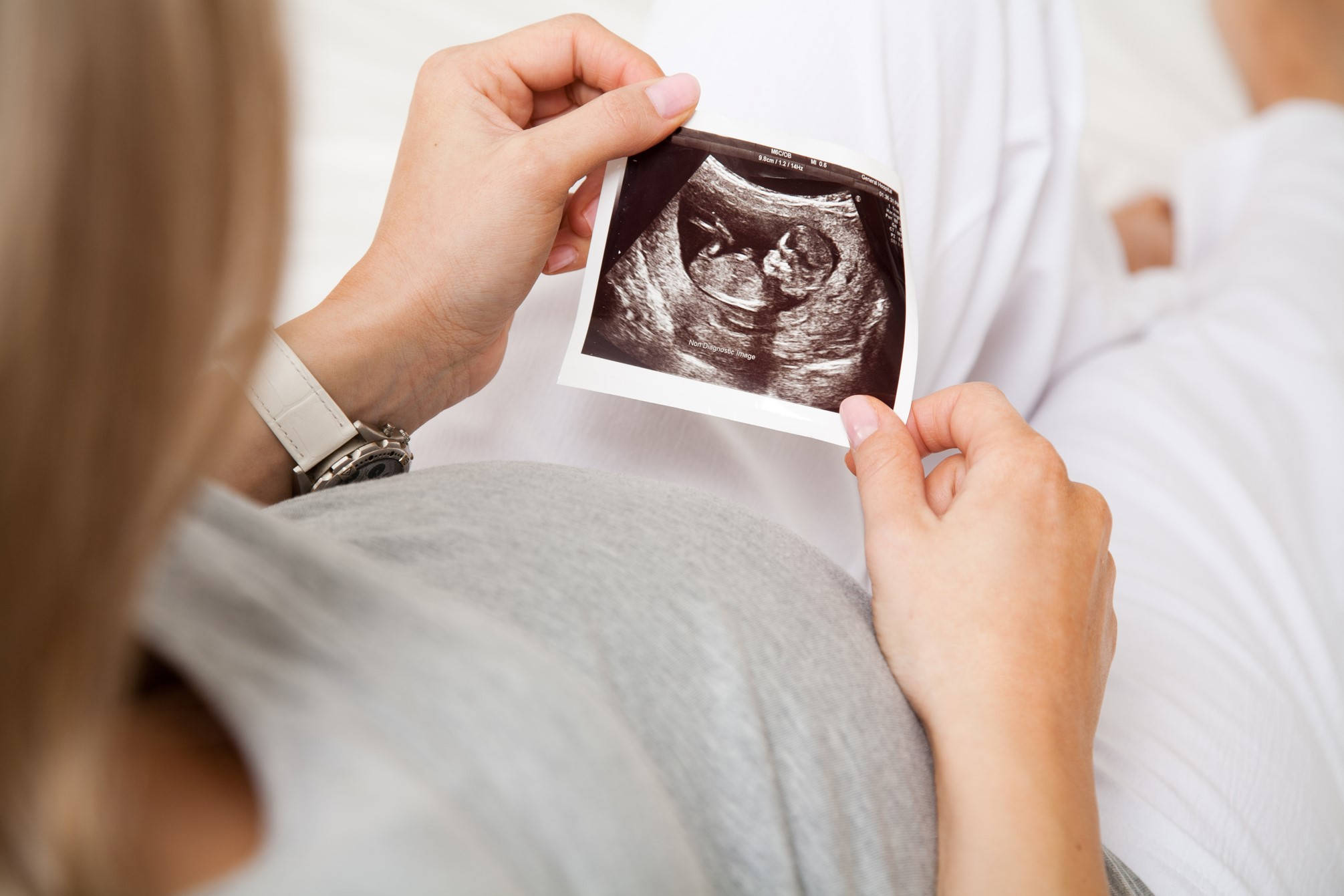 早孕女性的HCG波动很大