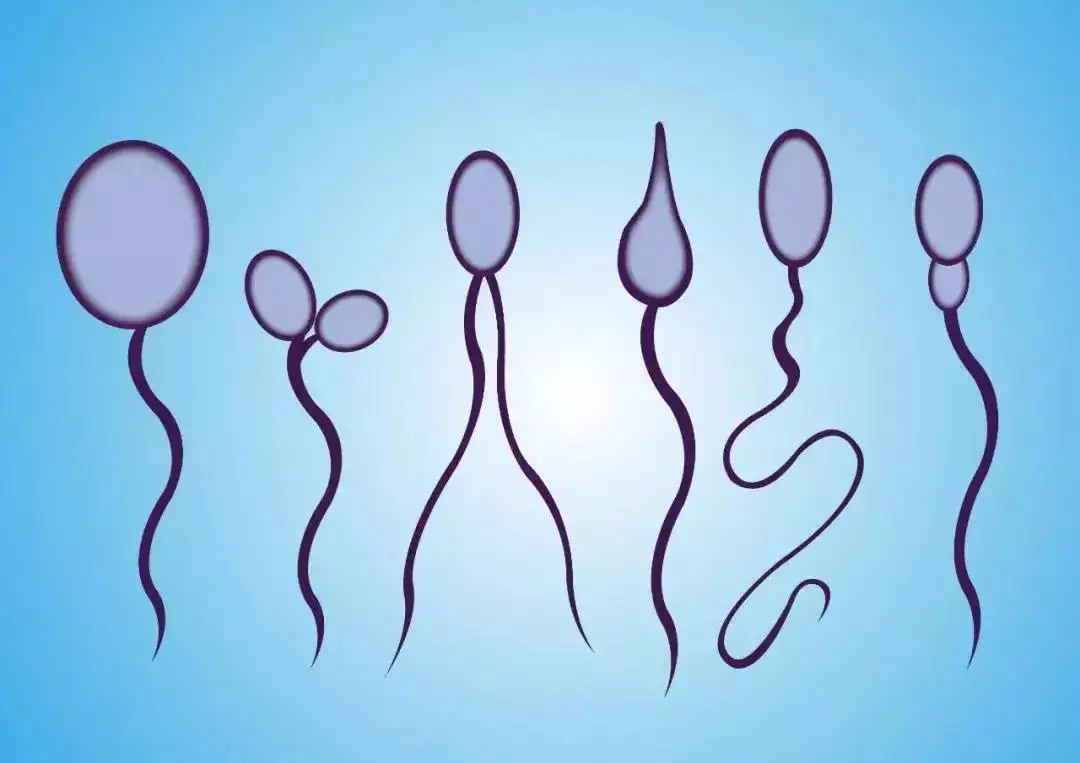 精子碎片率是判断精子质量的有效依据