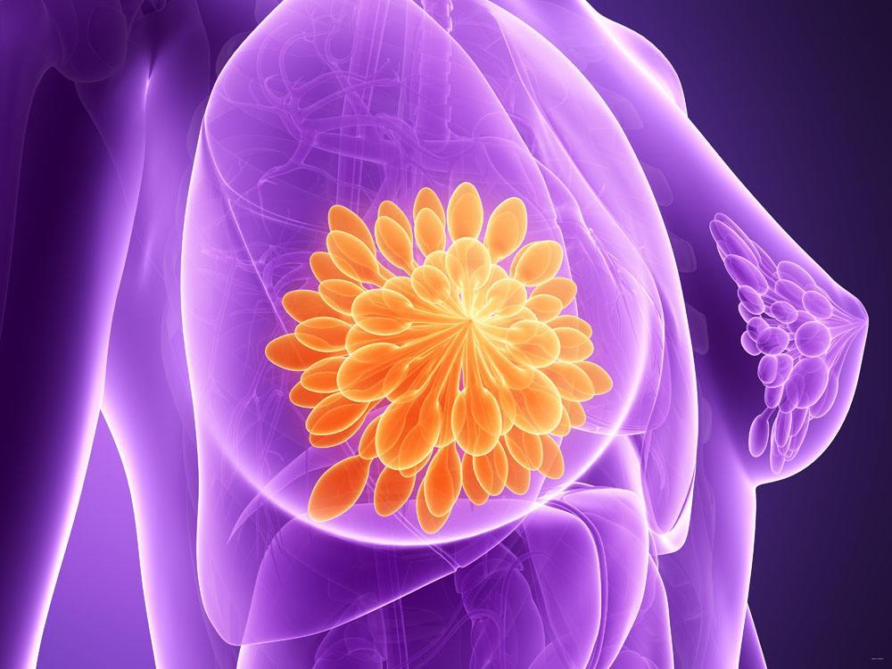 患有乳腺癌的女性禁止使用果纳芬