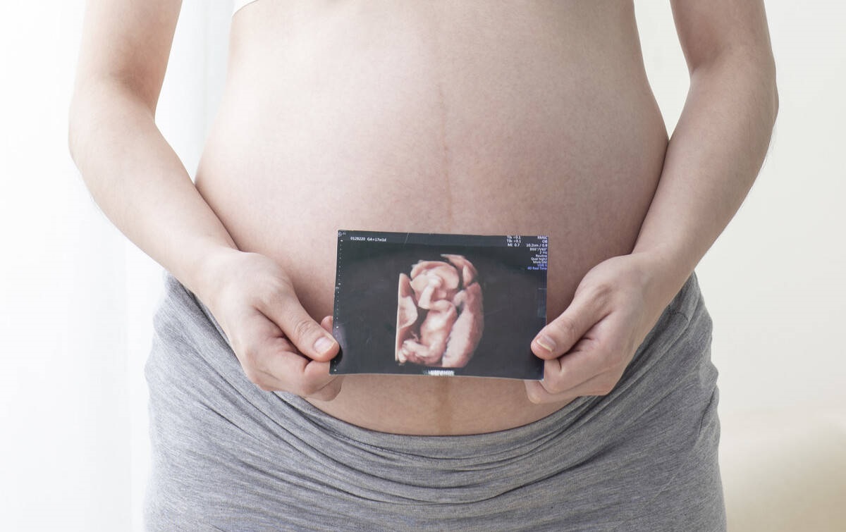 大排畸并不能观察出胎儿的性别