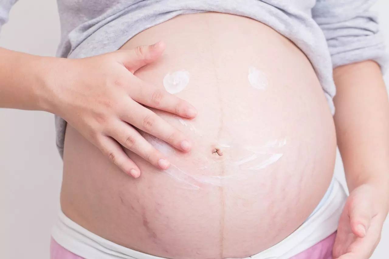 妊娠纹可以通过皮肤护理的办法祛除