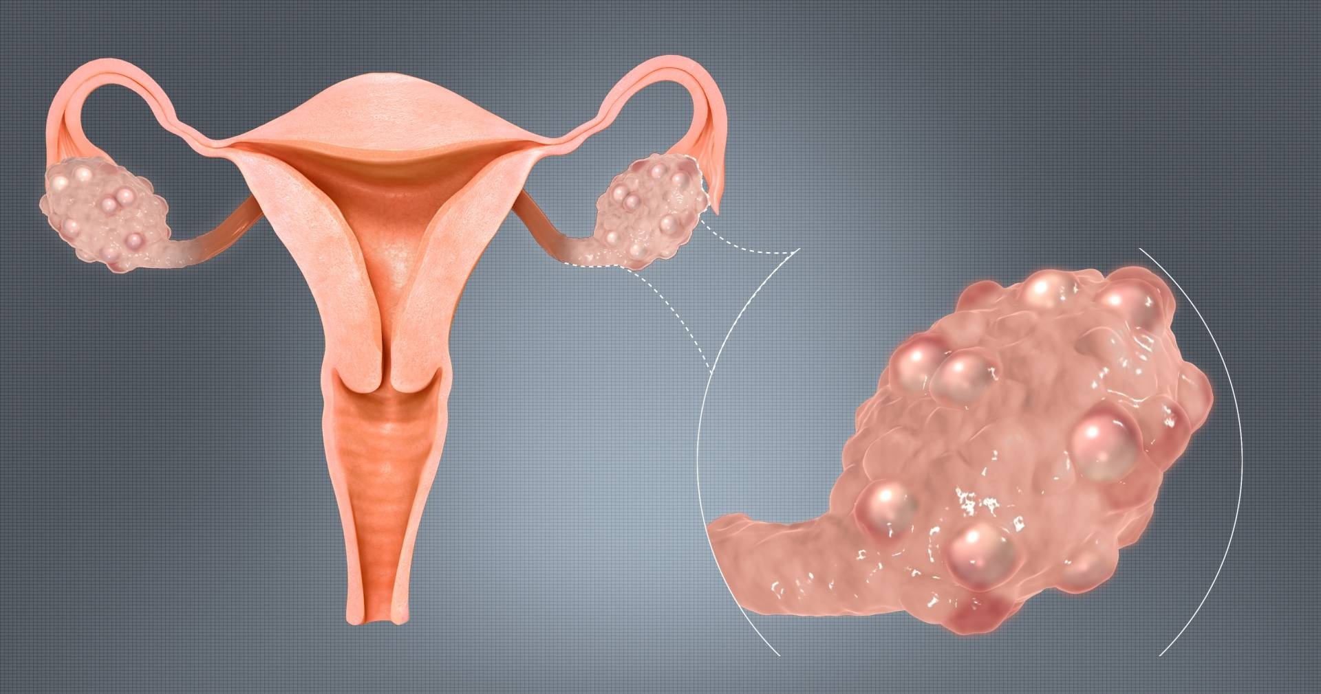 DHEA有保养卵巢的作用
