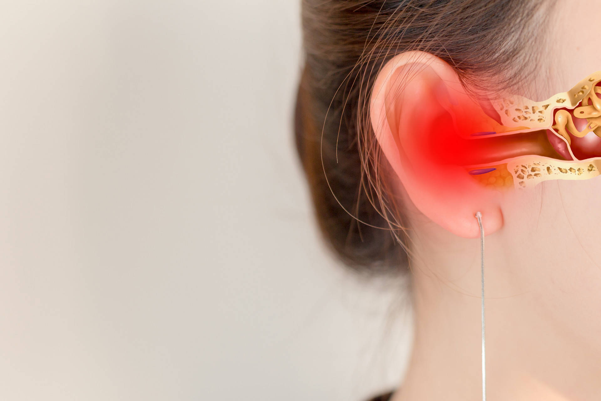 耳石症分为轻度和重度症状